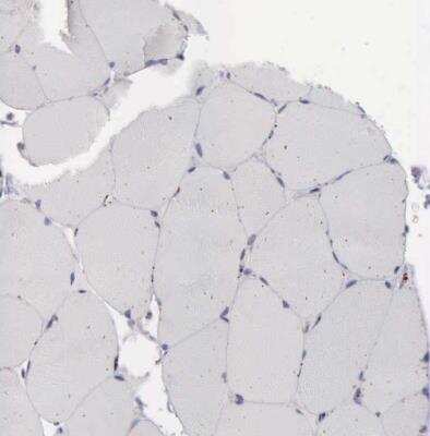 Immunohistochemistry-Paraffin: Niemann-Pick type C2 Antibody [NBP1-84012]