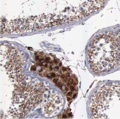Immunohistochemistry-Paraffin: Niemann-Pick type C2 Antibody [NBP1-84012]