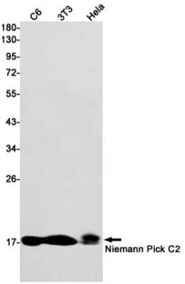 Western Blot: Niemann-Pick type C2 Antibody (S09-8D3) [NBP3-14872]