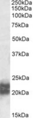 Western Blot: Niemann-Pick type C2 Antibody [NBP1-52028]