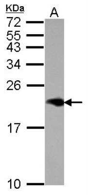 Western Blot: Niemann-Pick type C2 Antibody [NBP2-15044]