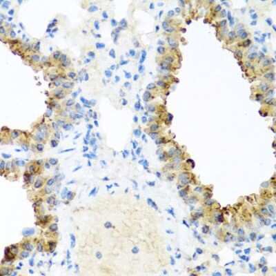 Immunohistochemistry-Paraffin: Ninein Antibody - BSA Free [NBP2-93990]