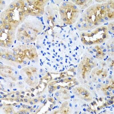 Immunohistochemistry-Paraffin: Ninein Antibody - BSA Free [NBP2-93990]