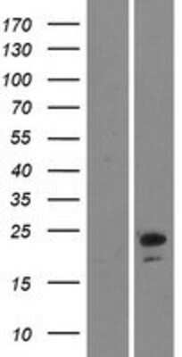 Western Blot: Ninjurin-2 Overexpression Lysate [NBP2-07023]