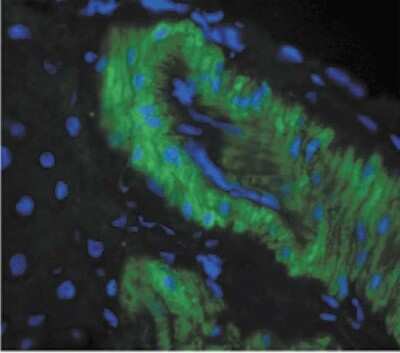 Immunohistochemistry: Nitrotyrosine Antibody (39B6) [NB110-96877]
