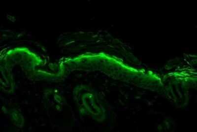 Immunohistochemistry: Nitrotyrosine Antibody (39B6) [NB110-96877]