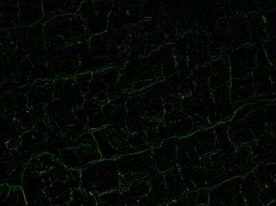 Immunohistochemistry-Frozen: Nitrotyrosine Antibody [NB100-2899]