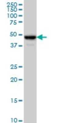 Western Blot: Njmu-R1 Antibody (2D7) [H00064149-M02]