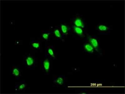 Immunocytochemistry/ Immunofluorescence: Njmu-R1 Antibody (3F8) [H00064149-M01]