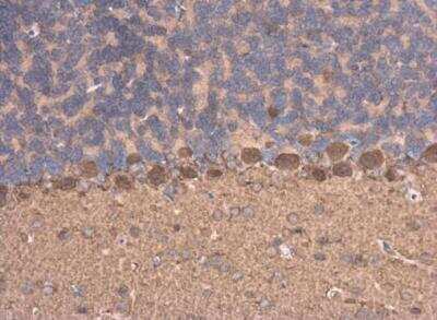 Immunohistochemistry-Paraffin: Njmu-R1 Antibody [NBP1-33006]