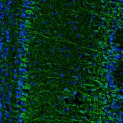 Immunohistochemistry-Paraffin: Njmu-R1 Antibody [NBP1-82563]