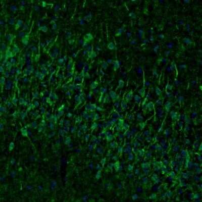 Immunohistochemistry-Paraffin: Njmu-R1 Antibody [NBP1-82563]
