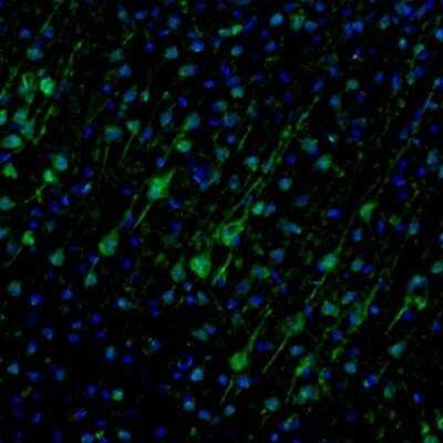 Immunohistochemistry-Paraffin: Njmu-R1 Antibody [NBP1-82563]