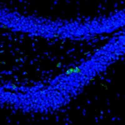 Immunohistochemistry-Paraffin: Njmu-R1 Antibody [NBP1-82563]