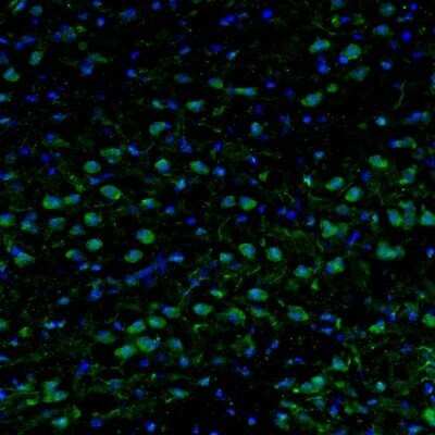 Immunohistochemistry-Paraffin: Njmu-R1 Antibody [NBP1-82563]