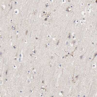 Immunohistochemistry-Paraffin: Njmu-R1 Antibody [NBP1-82563]