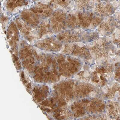 Immunohistochemistry-Paraffin: Njmu-R1 Antibody [NBP1-82563]