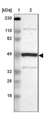 Western Blot: Njmu-R1 Antibody [NBP1-82563]