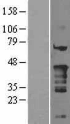 Western Blot: NKX2.5 Overexpression Lysate [NBL1-13659]