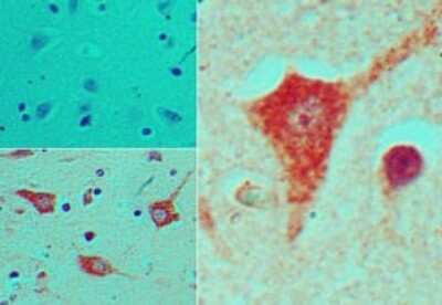 Immunohistochemistry-Paraffin: NKX2.5 Antibody [NBP2-24675]