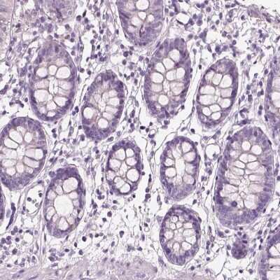 Immunohistochemistry-Paraffin: Nociceptin Antibody [NBP2-58314]