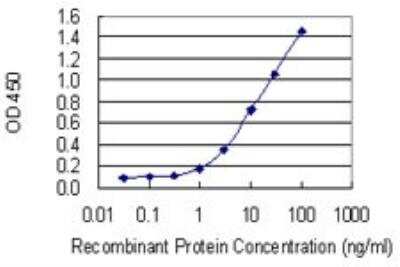 ELISA: Nocturnin Antibody (3E8) [H00025819-M01]