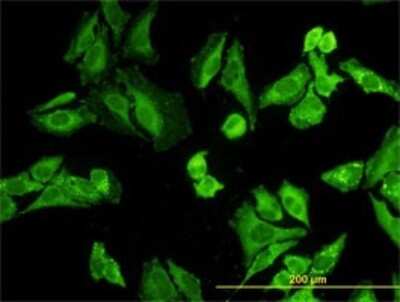 Immunocytochemistry/ Immunofluorescence: Nodal Antibody (5C3) [H00004838-M03]