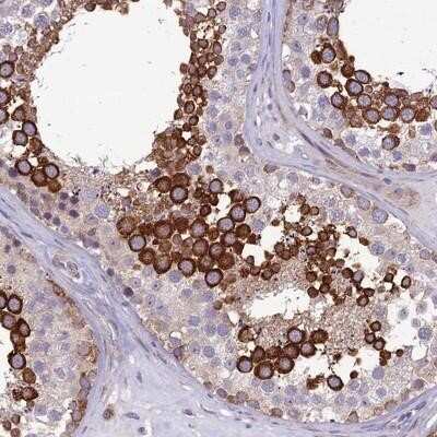 Immunohistochemistry-Paraffin: Nodal Antibody [NBP2-13664]