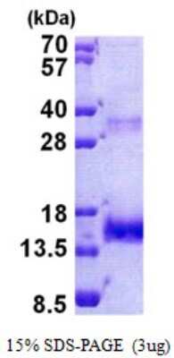 SDS-PAGE: Recombinant Human Olfactomedin-1/Noelin-1 His Protein [NBP2-23306]