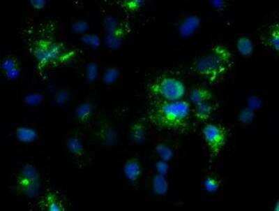 Immunocytochemistry/ Immunofluorescence: Noggin Antibody (OTI1H8) [NBP1-47881]