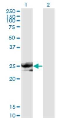 Western Blot: Noggin Antibody (2C10) [H00009241-M11]
