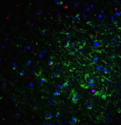 Immunocytochemistry/ Immunofluorescence: Nogo-A Antibody - BSA Free [NBP2-41071]