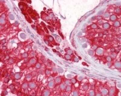 Immunohistochemistry-Paraffin: Nogo Antibody [NB100-56681]
