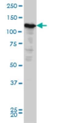 Western Blot: Nope/IGDCC4 Antibody (6E6) [H00057722-M03]