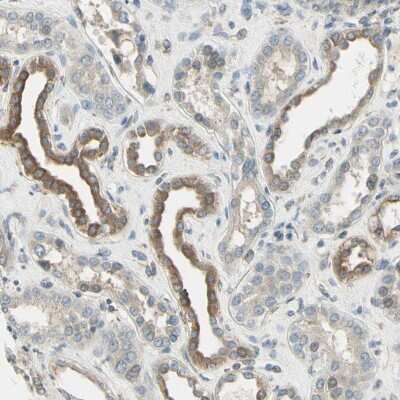 Immunohistochemistry-Paraffin: Nope/IGDCC4 Antibody [NBP1-92195]