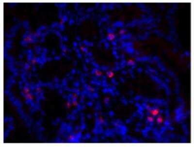 Immunohistochemistry-Paraffin: Normal Rabbit Serum [NBP1-71681]