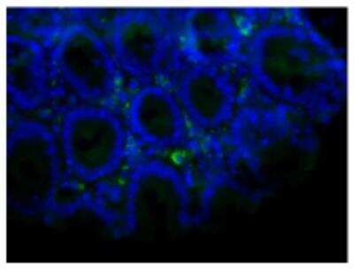 Immunohistochemistry-Paraffin: Normal Rabbit Serum [NBP1-71681]