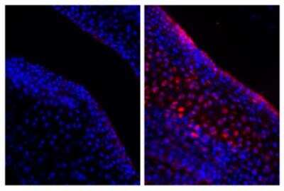 Immunohistochemistry-Paraffin: Normal Rabbit Serum [NBP1-71681]