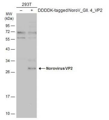 Western Blot: Norovirus VP2 Antibody [NBP3-13385]