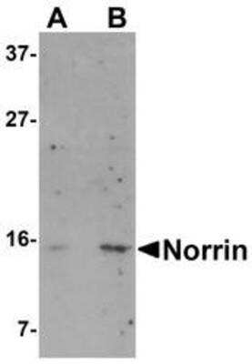 Western Blot: Norrin/NDP AntibodyBSA Free [NBP1-77014]
