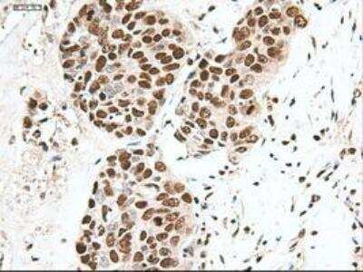 Immunohistochemistry-Paraffin: Notch-1 Antibody (OTI3E12) [NBP1-48289]