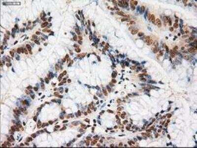 Immunohistochemistry-Paraffin: Notch-1 Antibody (OTI3E12) [NBP1-48289]