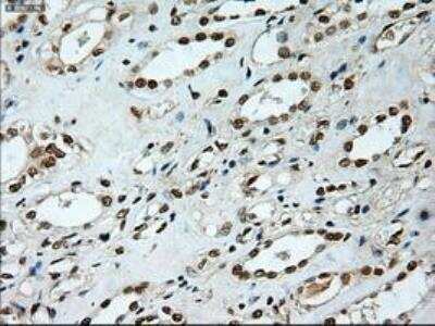 Immunohistochemistry-Paraffin: Notch-1 Antibody (OTI3E12) [NBP1-48289]