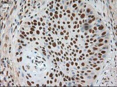 Immunohistochemistry-Paraffin: Notch-1 Antibody (OTI3E12) [NBP1-48289]