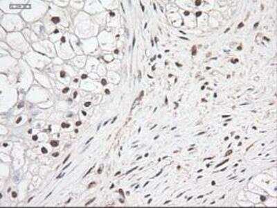 Immunohistochemistry-Paraffin: Notch-1 Antibody (OTI3E12) [NBP1-48289]