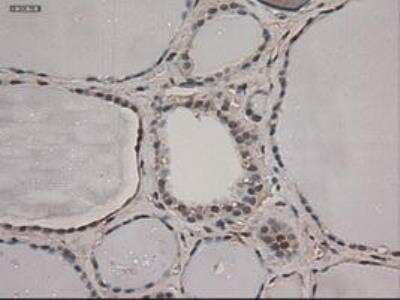 Immunohistochemistry-Paraffin: Notch-1 Antibody (OTI3E12) [NBP1-48289]