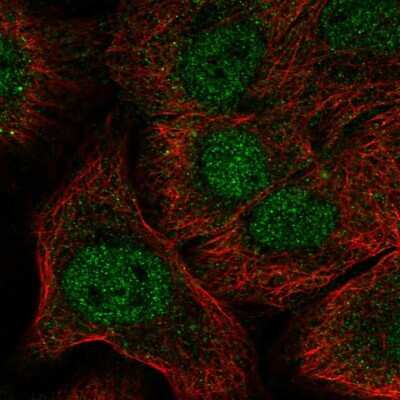 Immunocytochemistry/ Immunofluorescence: Notch-1 Antibody [NBP2-57913]