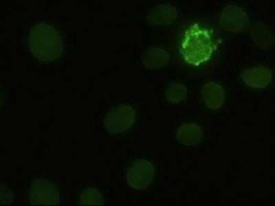 Immunocytochemistry/ Immunofluorescence: Notch-1 Antibody (OTI3E12) - Azide and BSA Free [NBP2-73042]