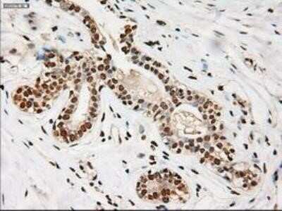 Immunohistochemistry: Notch-1 Antibody (OTI3E12) - Azide and BSA Free [NBP2-73042]