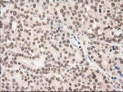 Immunohistochemistry: Notch-1 Antibody (OTI3E12) - Azide and BSA Free [NBP2-73042]